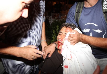 Οι εικόνες της ντροπής…