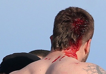 Έχει δίκιο ο Μπέος, από μύτη δεν βγαίνει τόσο αίμα (photos)