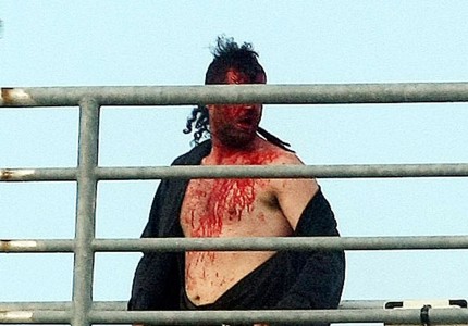 Έχει δίκιο ο Μπέος, από μύτη δεν βγαίνει τόσο αίμα (photos)