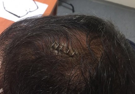 Έκτακτο! Ο Λουτσέσκου μιλά για Γκιουνές