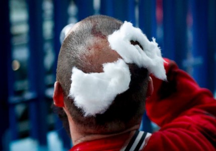 Δείτε την αλήτικη επίθεση στο Παπαστράτειο μέσω των φωτό!