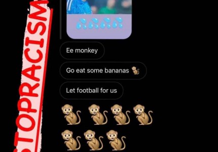 Ο Εμβιλά δέχτηκε ρατσιστική επίθεση, μετά το ντέρμπι! (photo)