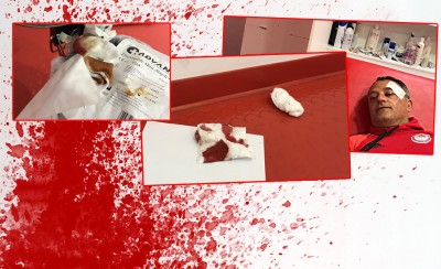 ΕΙΚΟΝΕΣ ΝΤΡΟΠΗΣ!