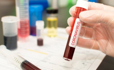 1 ακόμα θάνατος και 10 νέα κρούσματα