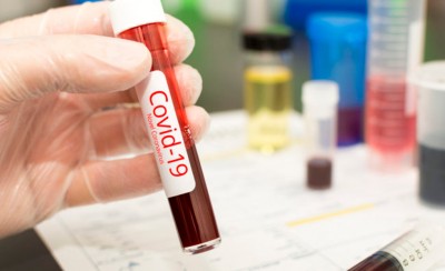 Μόλις 2 νέα κρούσματα, αλλά και 2 θάνατοι