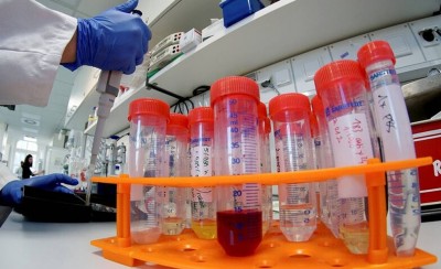 3 ακόμα νεκροί και 16 νέα κρούσματα