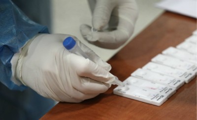 Κορονοϊός: 1.155 νέα κρούσματα και 78 θάνατοι