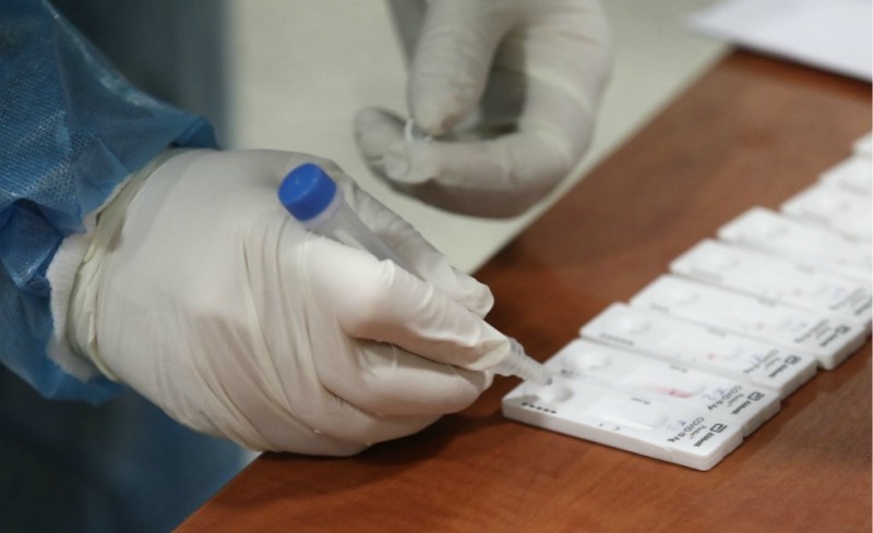 Κορονοϊός: 1.155 νέα κρούσματα και 78 θάνατοι